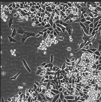 MIA-PaCa-2胰腺**细胞膜纳米金颗粒 MIA-PaCa-2胰腺**细胞膜纳米金颗粒